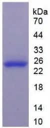 Human GSTP1 protein, His tag. GTX00125-pro