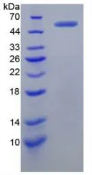 Human v-Myc protein, His and GST tag. GTX00126-pro