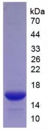 Human CD137 protein, His tag. GTX00128-pro