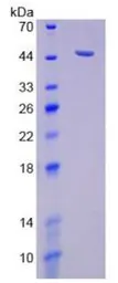 Human NEU1 protein, His tag. GTX00130-pro