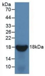 Human IL10 Receptor beta protein, His tag. GTX00131-pro