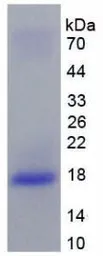Human IL10 Receptor beta protein, His tag. GTX00131-pro