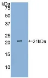 Human IL17E protein, His tag. GTX00133-pro