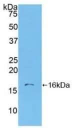Human S100A6 protein, His tag. GTX00135-pro