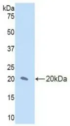 Human IL17 Receptor D protein, His tag. GTX00142-pro