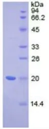 Human IL17 Receptor D protein, His tag. GTX00142-pro