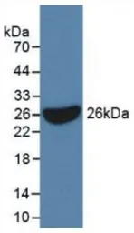Human IL17 Receptor C protein, His tag. GTX00143-pro