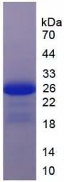 Human IL17 Receptor C protein, His tag. GTX00143-pro