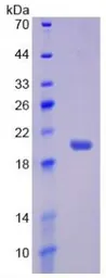 Human IL17 Receptor beta protein, His tag. GTX00144-pro
