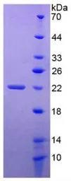 Human TNFRSF14 protein, His tag. GTX00145-pro