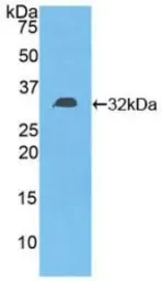 Human DGKE protein, His tag. GTX00146-pro