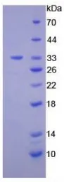 Human DGKE protein, His tag. GTX00146-pro