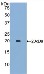 Human IL1F9 protein, His tag. GTX00148-pro
