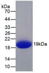 Human IL1F9 protein, His tag. GTX00148-pro