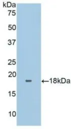 Human FNDC5 protein, His tag (active). GTX00149-pro