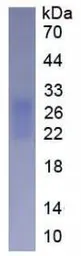 Human FNDC5 protein, His tag (active). GTX00150-pro