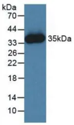 Human JAK2 protein, His tag. GTX00152-pro