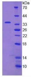 Human JAK2 protein, His tag. GTX00152-pro