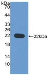 Human CD276 protein, His tag. GTX00156-pro
