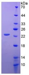 Human CD276 protein, His tag. GTX00156-pro