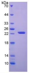 Human APRT protein, His tag. GTX00157-pro