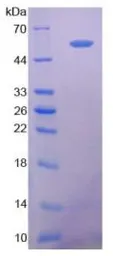 Human CD73 protein, His tag. GTX00159-pro
