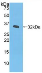 Human JAK3 protein, His tag. GTX00160-pro