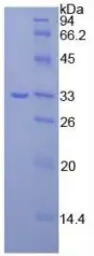 Human JAK3 protein, His tag. GTX00160-pro