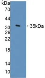 Human Arylsulfatase F protein, His tag. GTX00162-pro