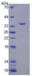 Human Arylsulfatase F protein, His tag. GTX00162-pro