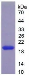 Human Vitamin D Receptor protein, His tag. GTX00163-pro