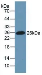 Human Fibronectin protein, His tag. GTX00166-pro