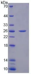 Human Fibronectin protein, His tag. GTX00166-pro