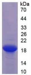 Human ESM1 protein, His tag. GTX00169-pro