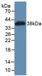 Human MAGP1 protein, His tag. GTX00174-pro