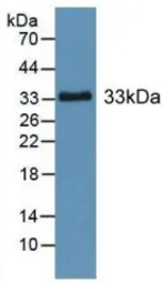 Human CES1 protein, His tag. GTX00177-pro
