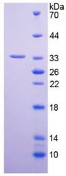 Human PAM protein, His tag. GTX00180-pro
