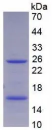 Human CD66e protein, His tag. GTX00181-pro