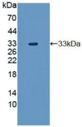 Human Tyrosine Aminotransferase protein, His tag. GTX00184-pro