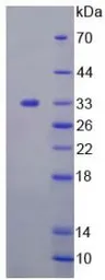 Human Tyrosine Aminotransferase protein, His tag. GTX00184-pro