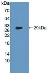 Human CD26 protein, His tag. GTX00187-pro