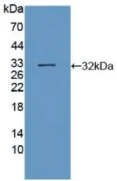 Human SIRT3 protein, His tag. GTX00190-pro