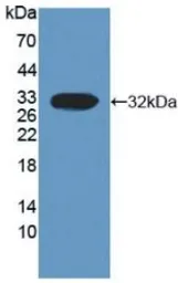 Human Calpain 3 protein, His tag. GTX00194-pro
