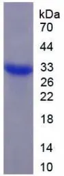 Human Calpain 3 protein, His tag. GTX00194-pro