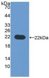 Human CYP3A4 protein, His tag. GTX00198-pro
