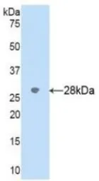Human Cytochrome P450 2D6 protein, His tag. GTX00199-pro