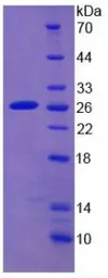 Human Cytochrome P450 2D6 protein, His tag. GTX00199-pro