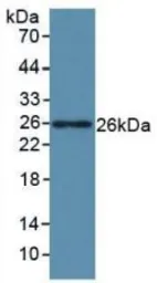 Human LIF protein, His tag (active). GTX00201-pro