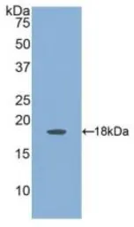 Human Angiopoietin 2 protein, His tag. GTX00212-pro