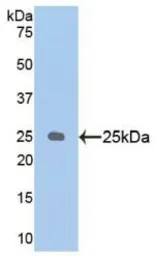 Human NPEPPS protein, His tag. GTX00222-pro